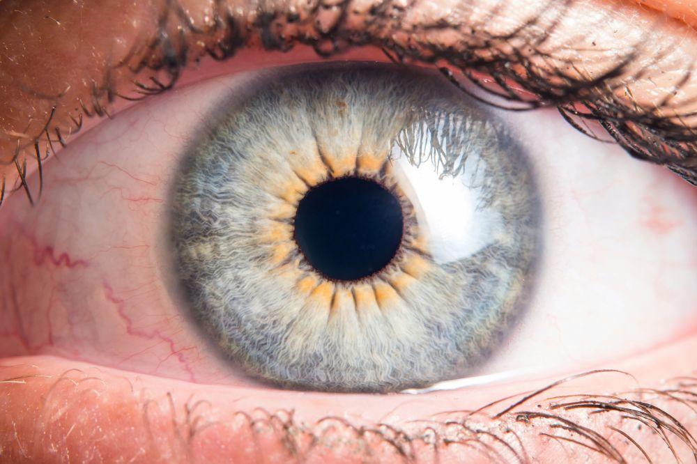 ZBOG CIGARETA MOŽETE OSTATI BEZ VIDA: Kad se krvni sudovi oka začepe preti nam INFARKT OKA