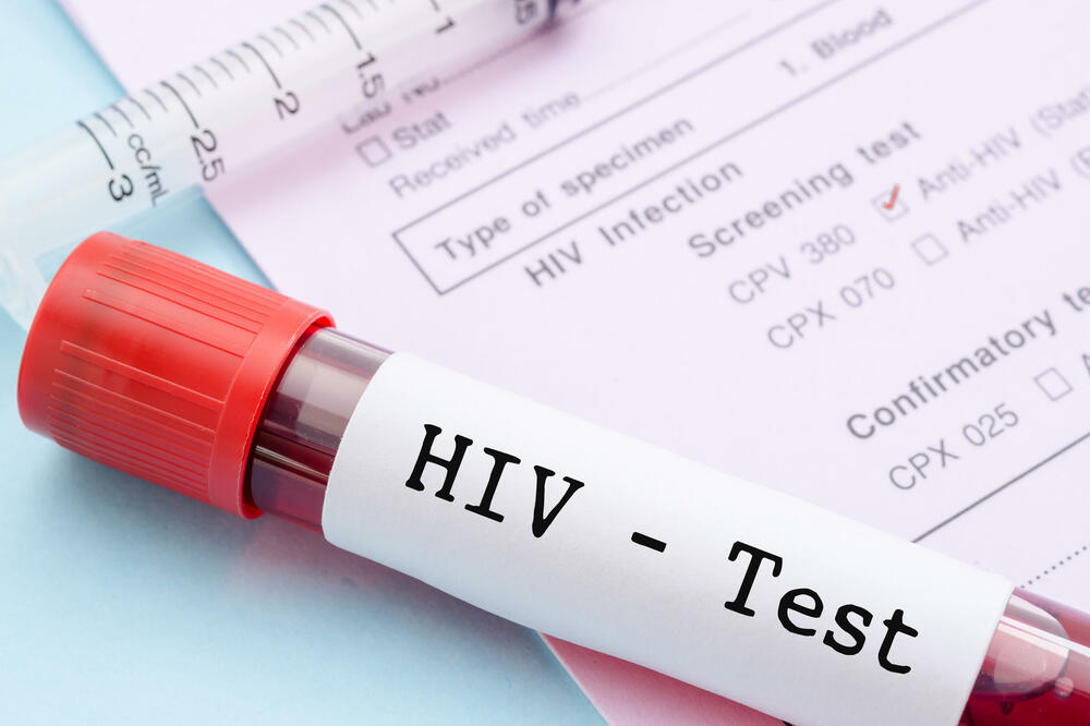 TESTIRAJ, LEČI, ZAŠTITI: Počela Evropska nedelja testiranja na HIV
