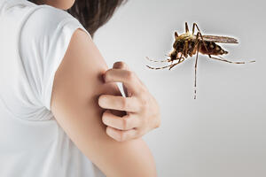 Zašto svrbi ujed komaraca? Evo šta vam može pomoći