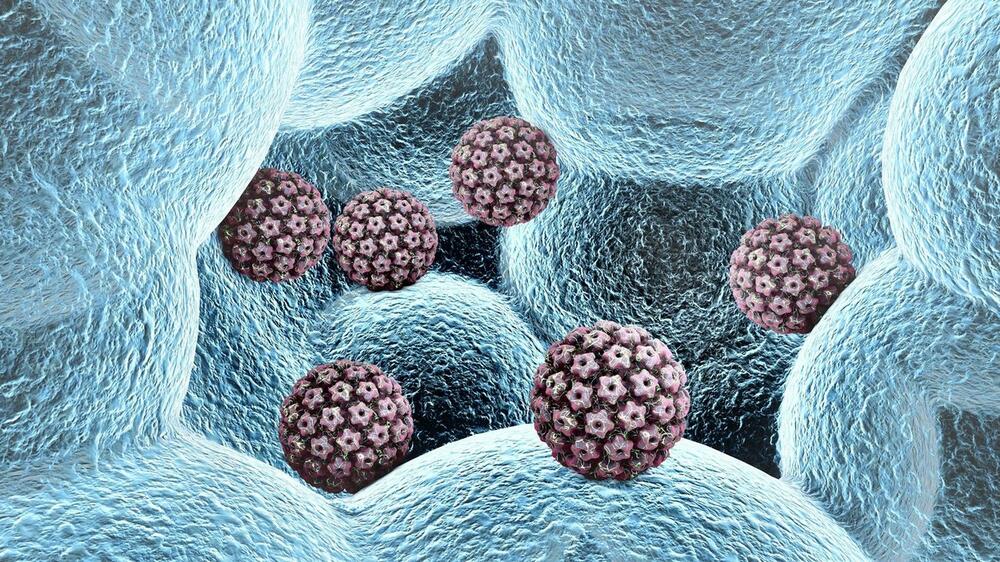 U 2018. bilo oko 69.400 slučajeva raka kod muškaraca izazvanih HPV-om.