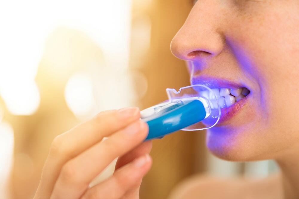 Skupi kompleti za izbeljivanje sa plavim svetlima za izbeljivanje zuba mogu doneti više štete nego koristi.