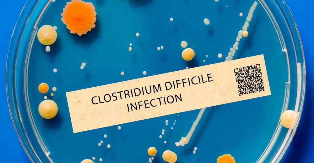 Sa nekontsolisanom upotrebom antibiotika broj osoba sa infekcijama clostridijuma se povećava