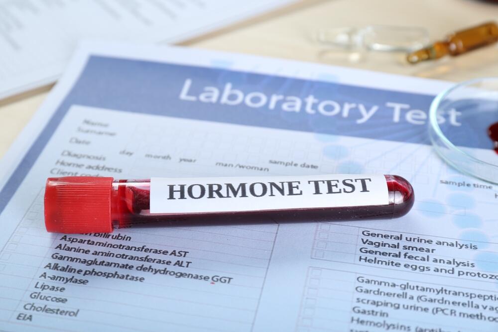 test hormona