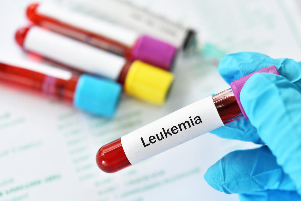 leukemija, test krvi