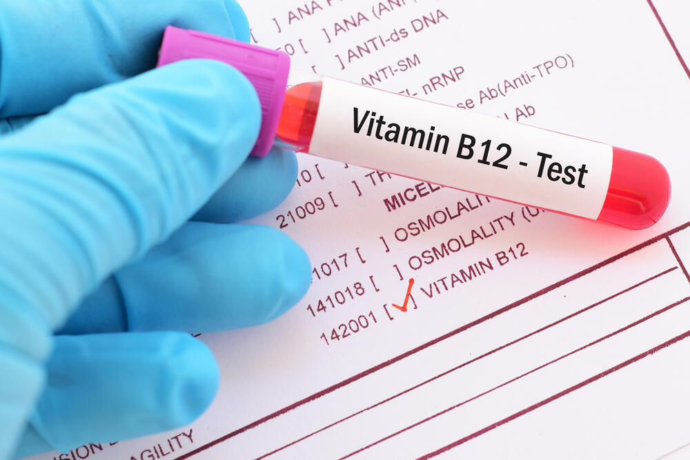 vitamin B12, vitamin B, vitamini, izvor vitamina B12