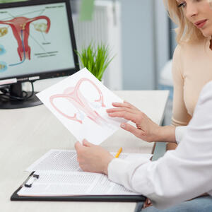 Gubitak jajnika može ozbiljno uticati na mozak: Manjak testosterona i estrogena