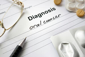 3 grupe posebno ugrožene od raka usne duplje: Svake godine od ove bolesti oboli 500 ljudi