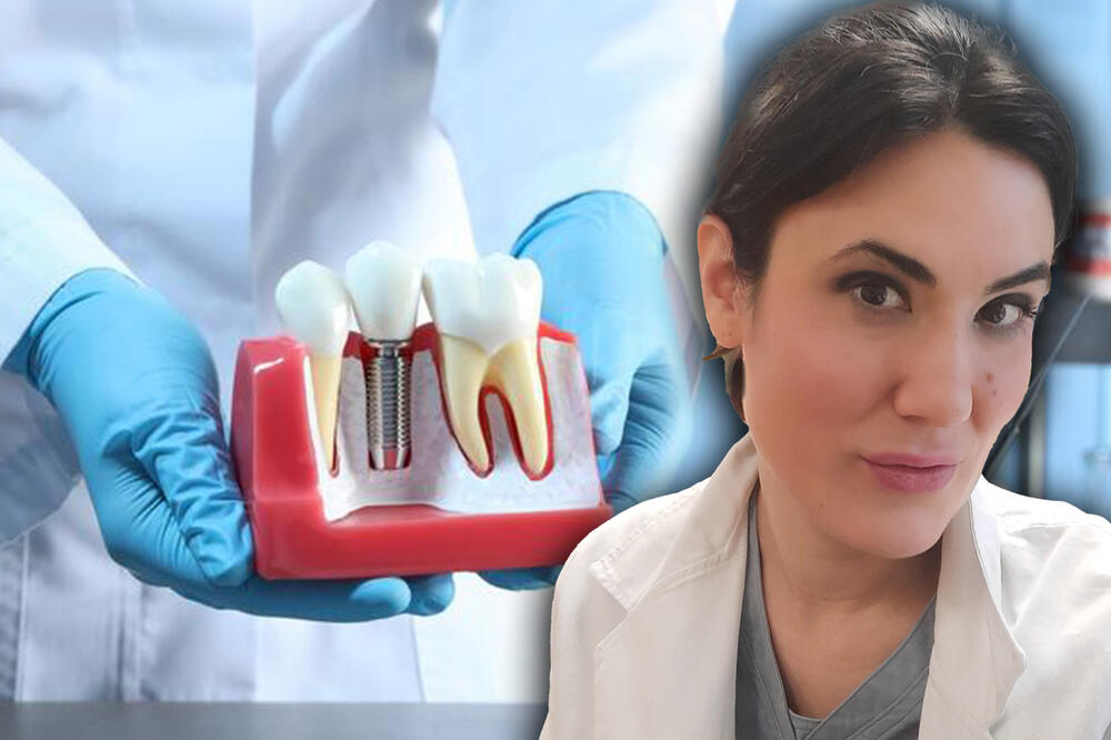 Stomatolog otkriva sve o zubnim implantima: Od jednog zuba do nadoknade cele vilice
