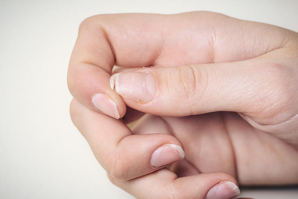 Hormonske promene u menopauzi utiču na strukturu i kvalitet noktiju