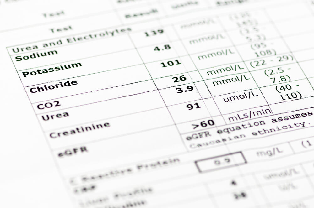 urea u krvi, analiza krvi, test krvi, Laboratorija, laboratorijske analize
