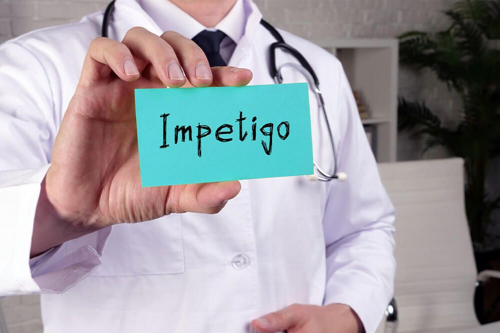 Impetigo je česta letnja infekcija kože: Evo koji su prvi simptomi i kako se leči